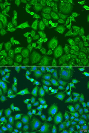 Immunofluorescence - KIF11 antibody (144-07907)