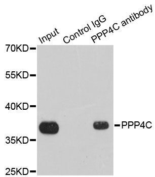 Immunoprecipitation - PPP4C Polyclonal Antibody (144-02109)