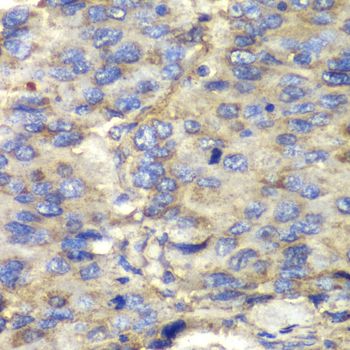 Immunohistochemistry - SDHA Polyclonal Antibody (144-02594)