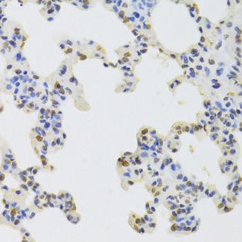Immunohistochemistry - HNRNPD Polyclonal Antibody (144-01828)