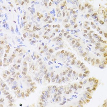 Immunohistochemistry - HDGF Antibody (144-05347)