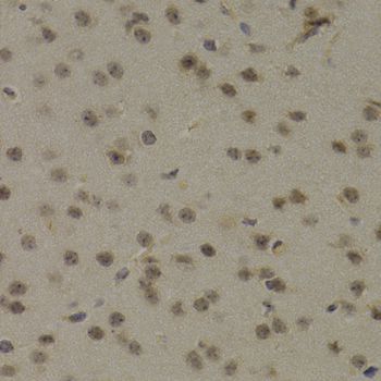 Immunohistochemistry - PAWR Antibody (144-03063)