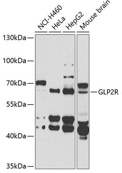Western blot