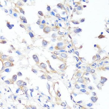 Immunohistochemistry - EGFR Polyclonal Antibody (144-011577)