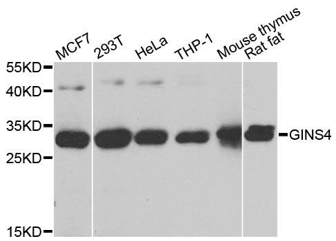 Western blot - GINS4 antibody (144-08592)