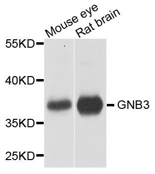 Western blot - GNB3 antibody (144-01387)