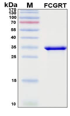 SDS-PAGE Image