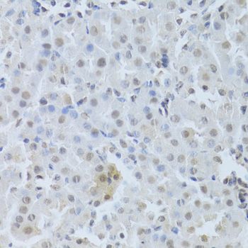 Immunohistochemistry - CDK4 Polyclonal Antibody (144-00366)