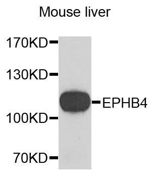 Western blot - EPHB4 antibody (144-03293)