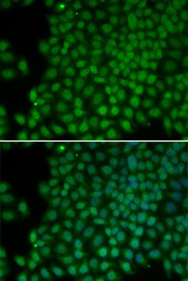 Immunofluorescence - POLR1C Polyclonal Antibody (144-00269)