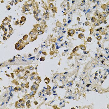 Immunohistochemistry - NPC2 Antibody (144-05413)