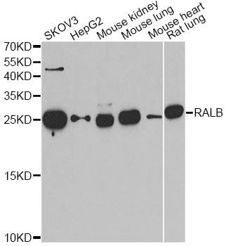Western blot - RALB Polyclonal Antibody (144-06714)