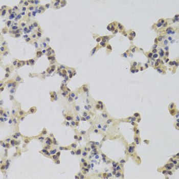 Immunohistochemistry - HDGF Antibody (144-05347)