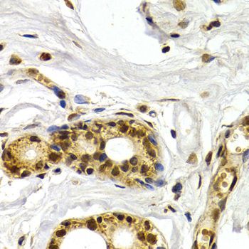 Immunohistochemistry - ATF2 Polyclonal Antibody (144-02155)