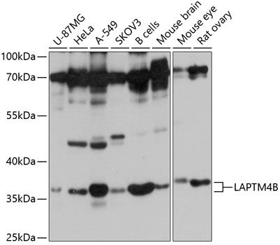 Western blot