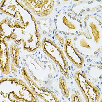 Immunohistochemistry - GLRX Antibody (144-05315)