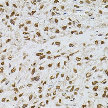 Immunohistochemistry - TGM2 Polyclonal Antibody (144-00981)