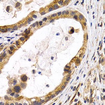 Immunohistochemistry - HSPB8 antibody (144-02514)