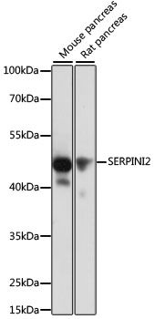 Western blot - SERPINI2 antibody (144-60074)