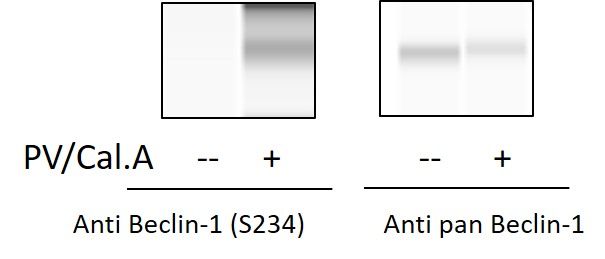 Beclin-1 (S234) - Western Blot