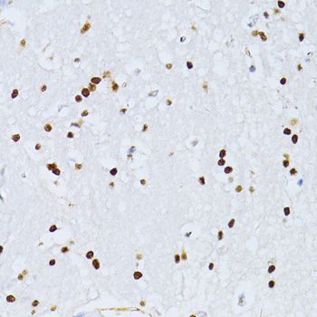 Immunohistochemistry - ZEB2 Polyclonal Antibody (144-05705)