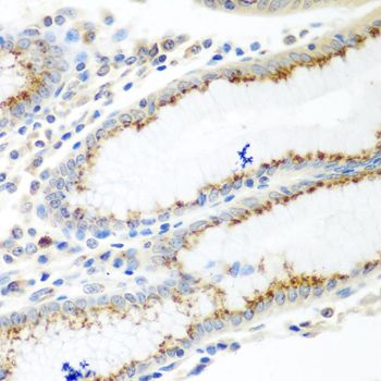 Immunohistochemistry - UBIAD1 antibody (144-07640)