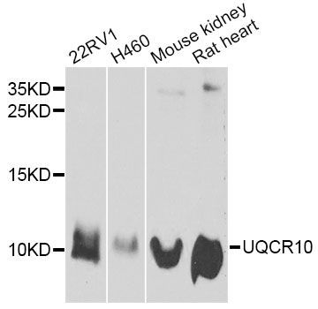 Western blot - UQCR10 Polyclonal Antibody (144-12587)