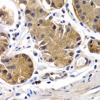 Immunohistochemistry - PTGIR Polyclonal Antibody (144-01849)