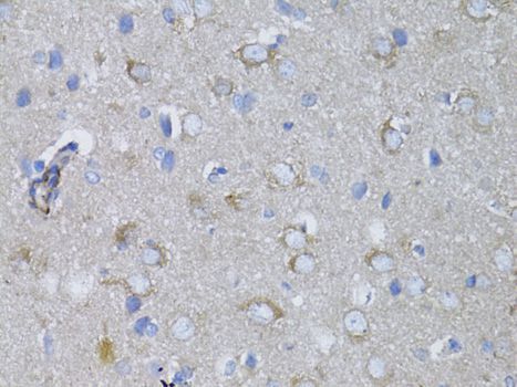 Immunohistochemistry - MYH10 antibody (144-012029)