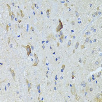 Immunohistochemistry - SARS Polyclonal Antibody (144-06733)