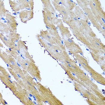 Immunohistochemistry - SRI antibody (144-06751)