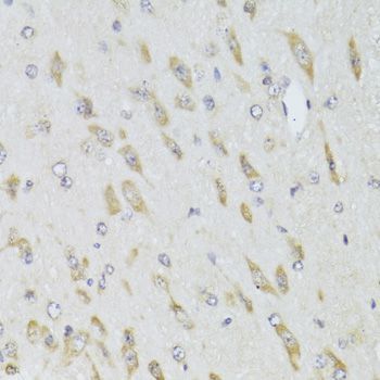 Immunohistochemistry - RPL13 Polyclonal Antibody (144-06723)