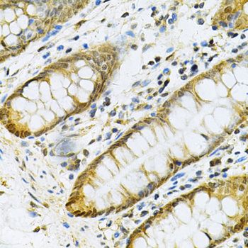 Immunohistochemistry - PGK1 Antibody (144-60560)