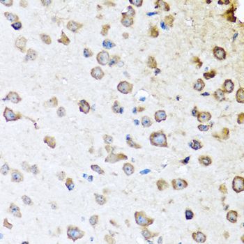 Immunohistochemistry - SERPINA10 Polyclonal Antibody (144-07106)