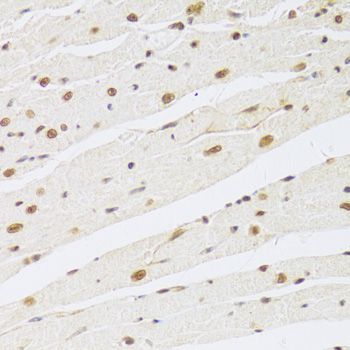 Immunohistochemistry - MAPK3 Polyclonal Antibody (144-00228)