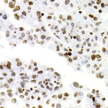 Immunohistochemistry - NFKB2 Polyclonal Antibody (144-03108)