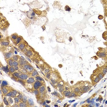 Immunohistochemistry - GYS1 antibody (144-02519)