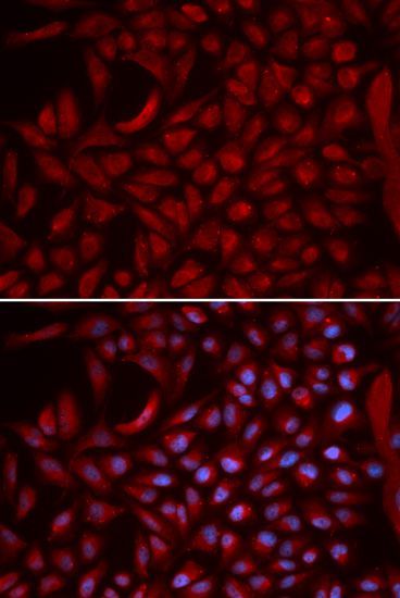 Immunofluorescence - CUL5 antibody (144-05369)
