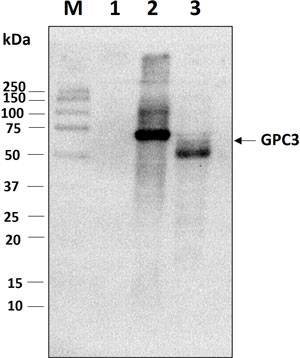 Western blot