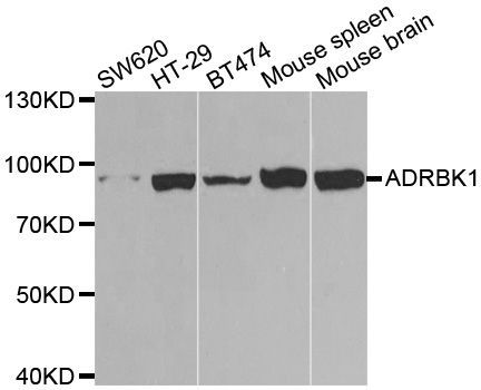 Western blot - [KO Validated] ADRBK1 Polyclonal Antibody (144-01662)