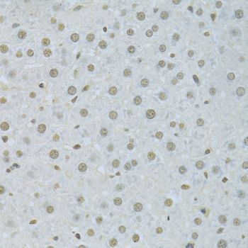 Immunohistochemistry - HNRNPK Antibody (144-01701)