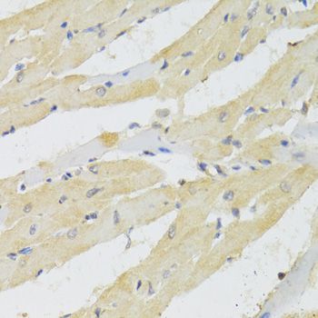 Immunohistochemistry - TRAP1 Antibody (144-02748)