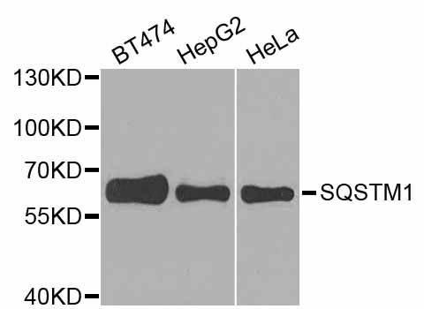 Western blot - SQSTM1 Polyclonal Antibody (144-011483)