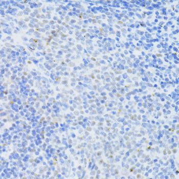 Western blot - DNMT1 Polyclonal Antibody (144-05495)