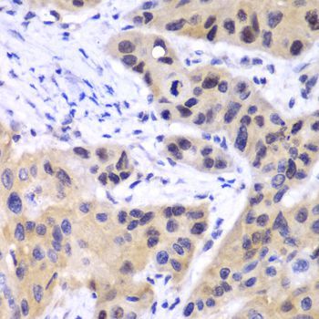 Immunohistochemistry - [KO Validated] IRF3 Polyclonal Antibody (144-11118)