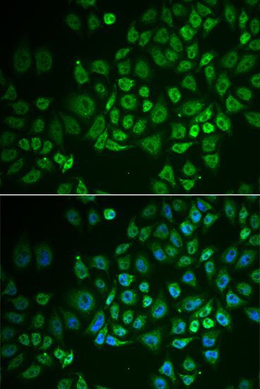 Immunofluorescence - GPLD1 Polyclonal Antibody (144-06612)