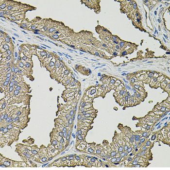 Immunohistochemistry - SMN2 antibody (144-12508)