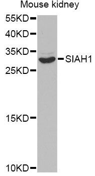 Western blot - SIAH1 antibody (144-02494)