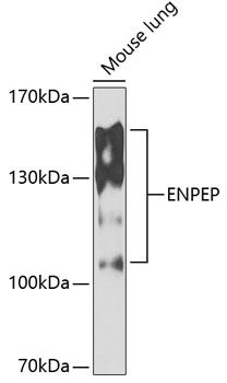 Western blot