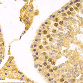 Immunohistochemistry - RFC4 Polyclonal Antibody (144-05485)